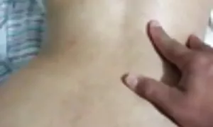 na prolapse anal nke ...