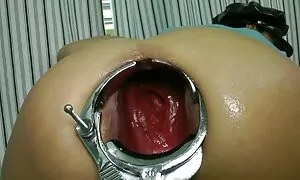 prolapse ya speculum ...