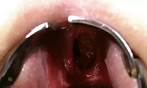 fisting anal double, ...