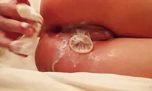 anal ya mvimba ti sp ...